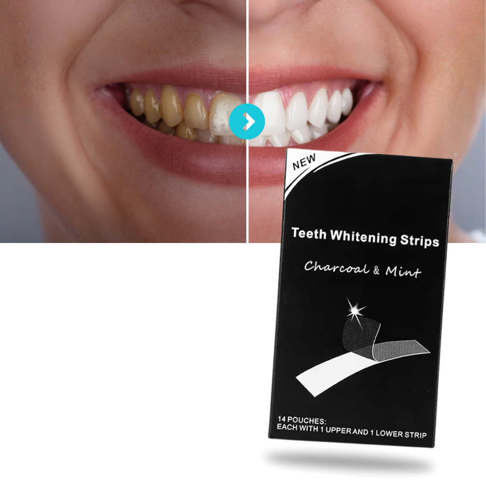 Minty Charcoal Teeth Strips - Ozerty