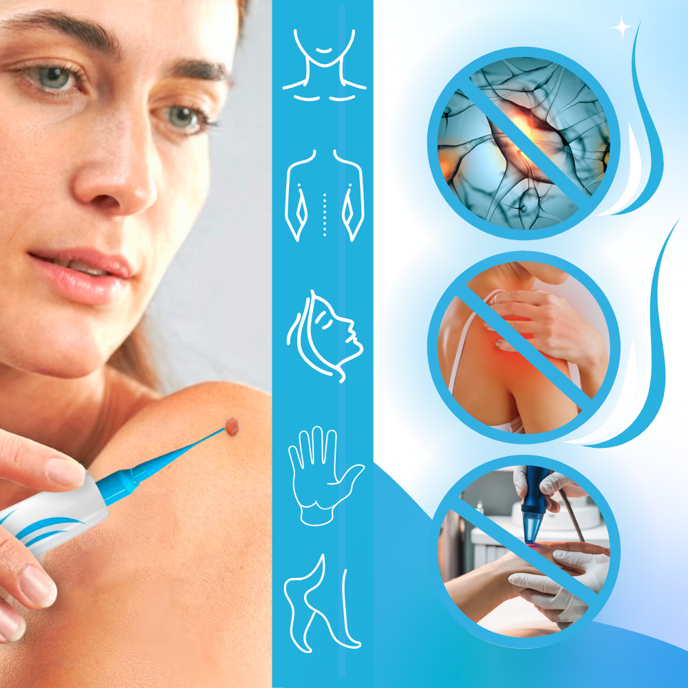 Skin Tag Removal Pro - Ozerty