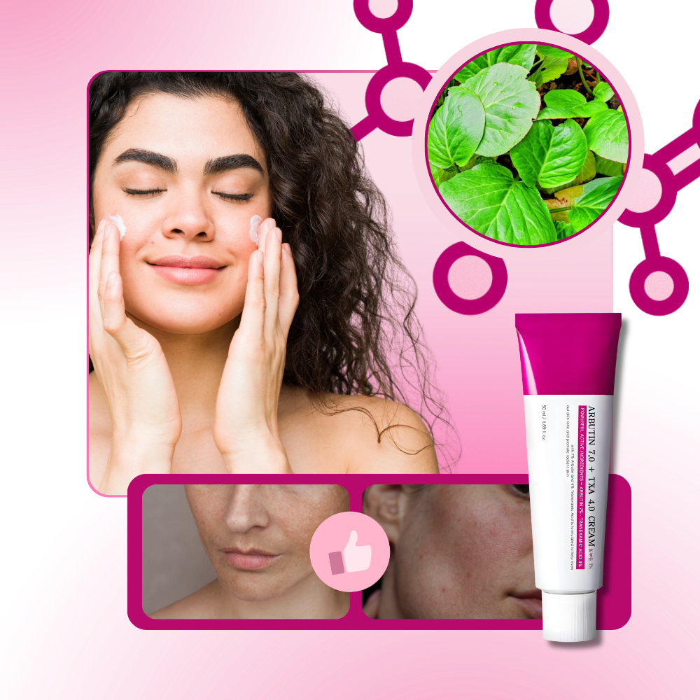 Even Skin Tranexamic Cream - Ozerty