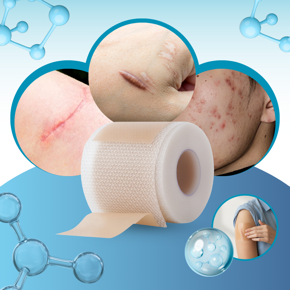 Hyaluronic Silicone Scar Patch - Ozerty