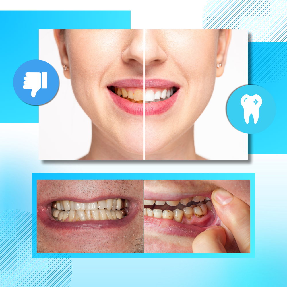 Minty Charcoal Teeth Strips - Ozerty