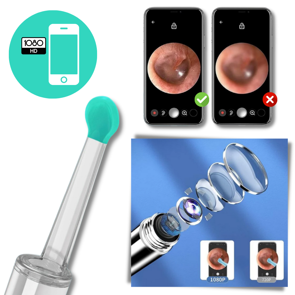 Smart Ear Wax Removal Camera - Ozerty