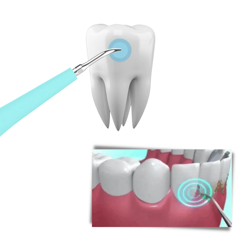 Deep Cleaning Tooth Tartar Machine