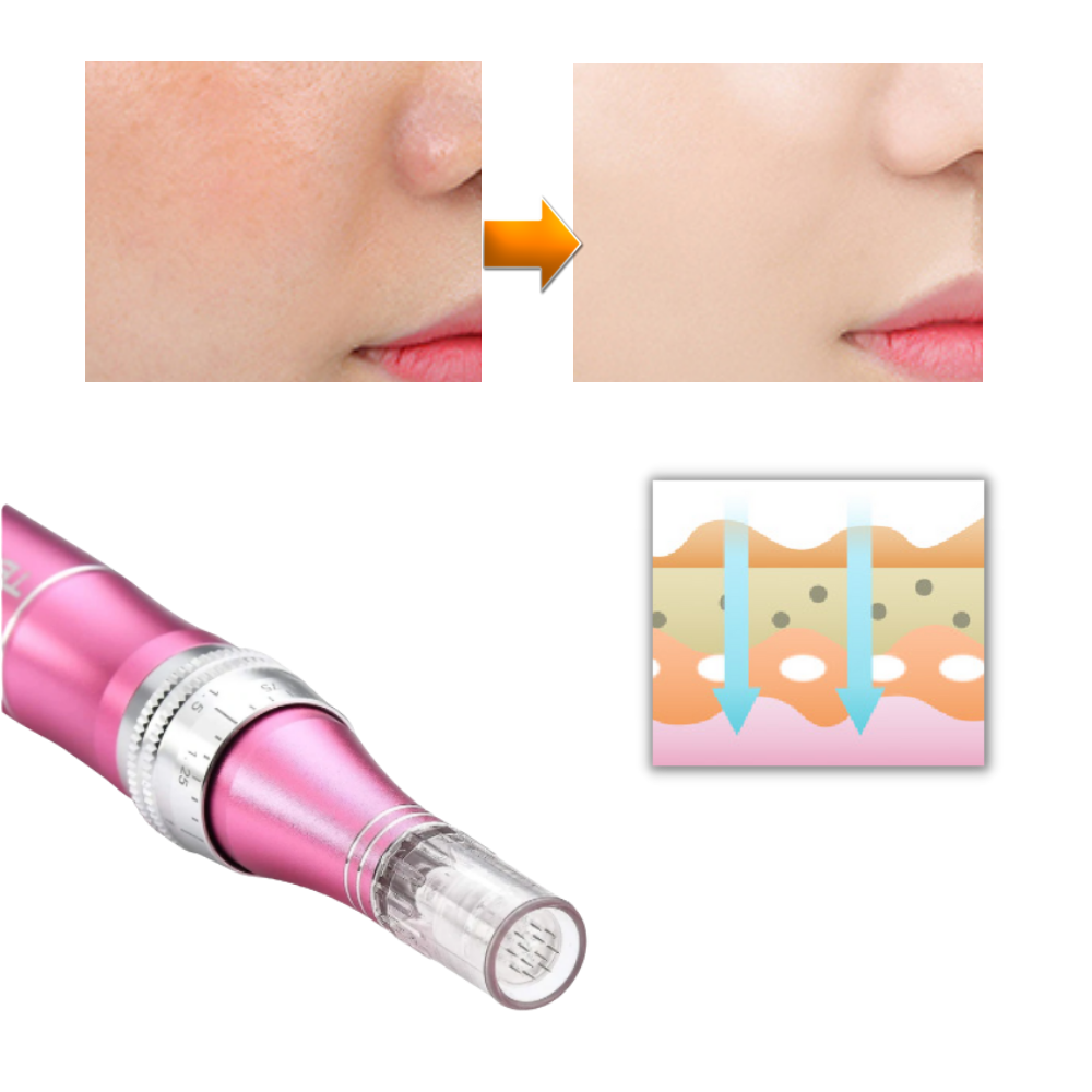 Dermal Microneedling Pen